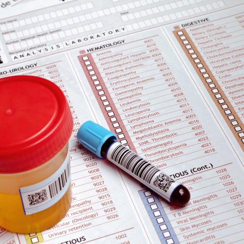Blood Tests at Home in West Kent & Bromley Blood Tests at Home in West Kent & Bromley